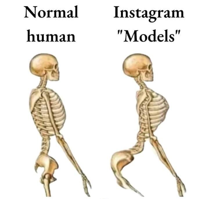 Skeleton of normal human vs skeleton of instagram models - Chameleon Memes