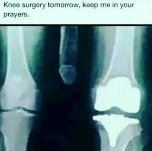15 'Knee Surgery Memes' to Make You Laugh Through the Pain 1 knee surgery tommorow