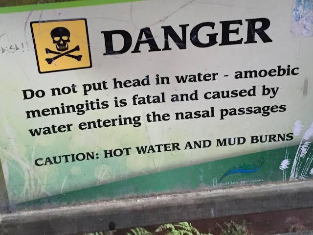 23 Warning Signs That Caught Attention 8 Do not put head in water