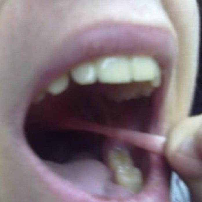 30 Cursed Pics to Infuse Your Day with Weird Vibes, As Shared On This IG Page 17 Cursed uvula - cursed pics