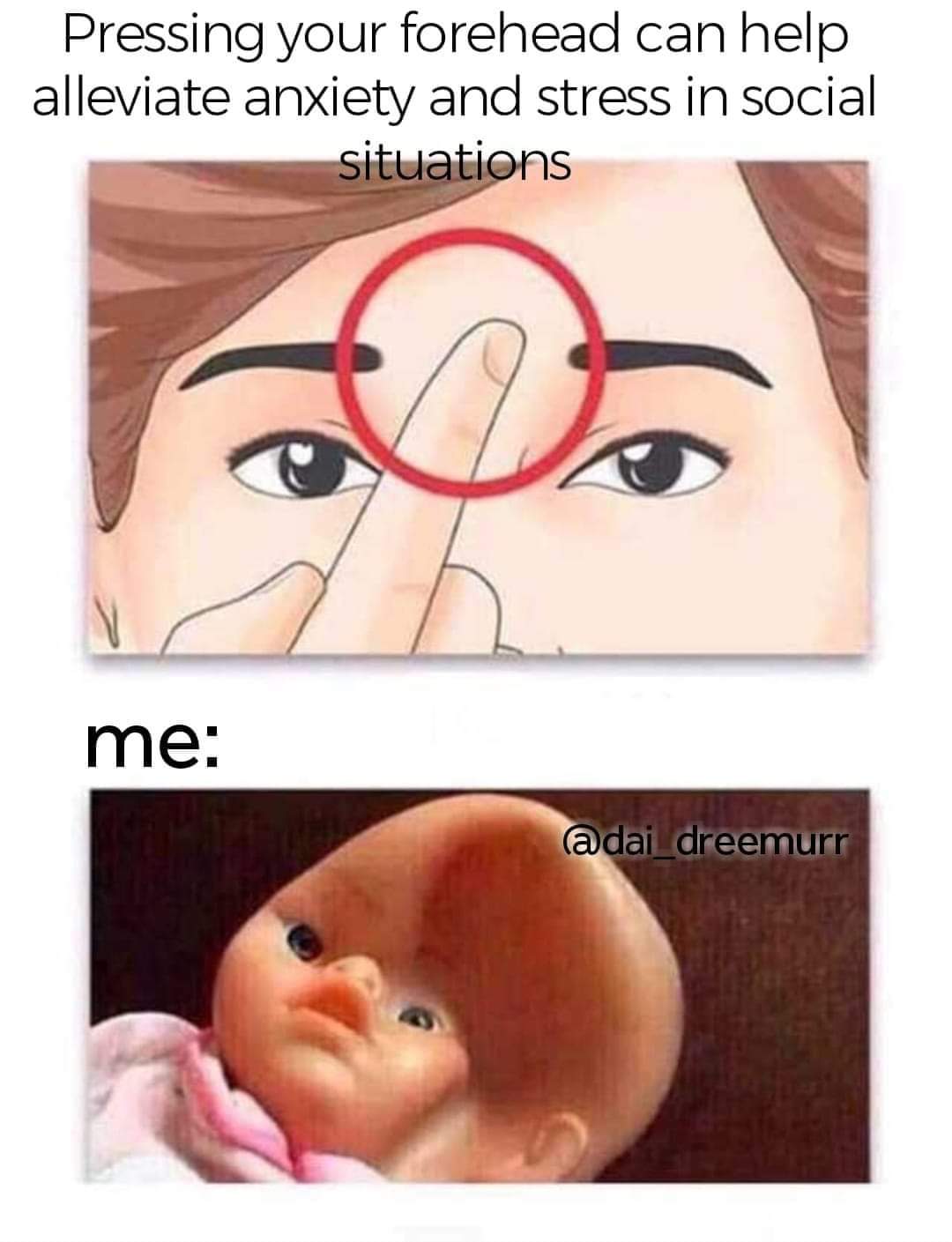 18 Sad Memes About Life: Laughing Through Life's Tears 11 pressing your forehead - sad memes about life