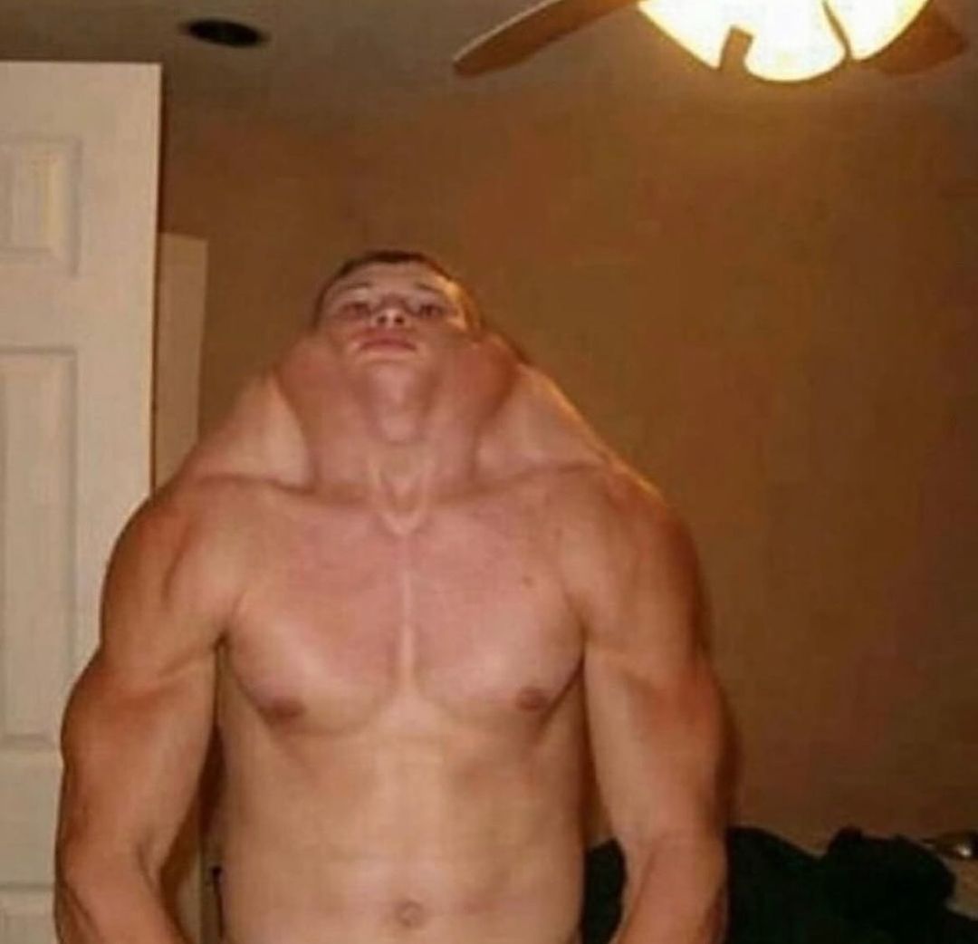 20 Cursed Images You’ll Wish You Could Unseen 18 Skipped neck day - cursed images