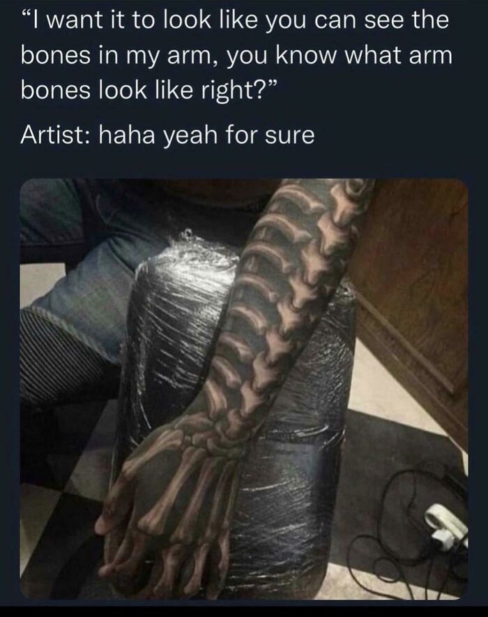 bones in arm