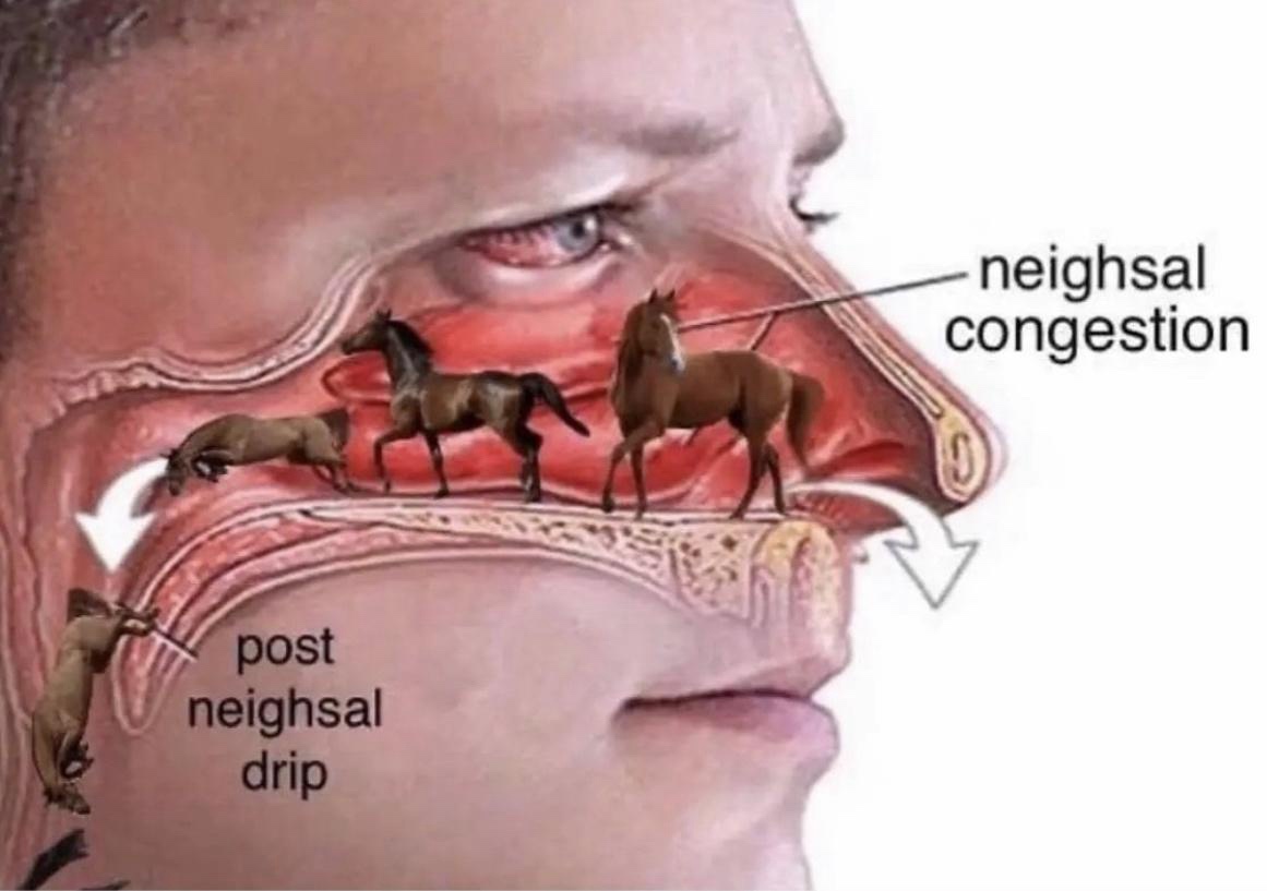 25 Memes So Absurd, They Should Be Taught in Philosophy Class 11 Neighsal congestion