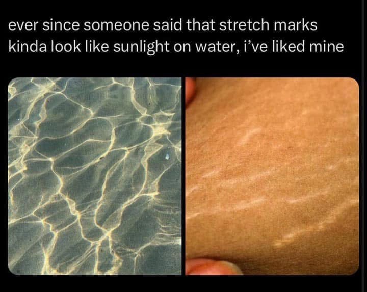 20 Memes You Can’t Scroll Past Without Laughing 18 Stretch marks look like