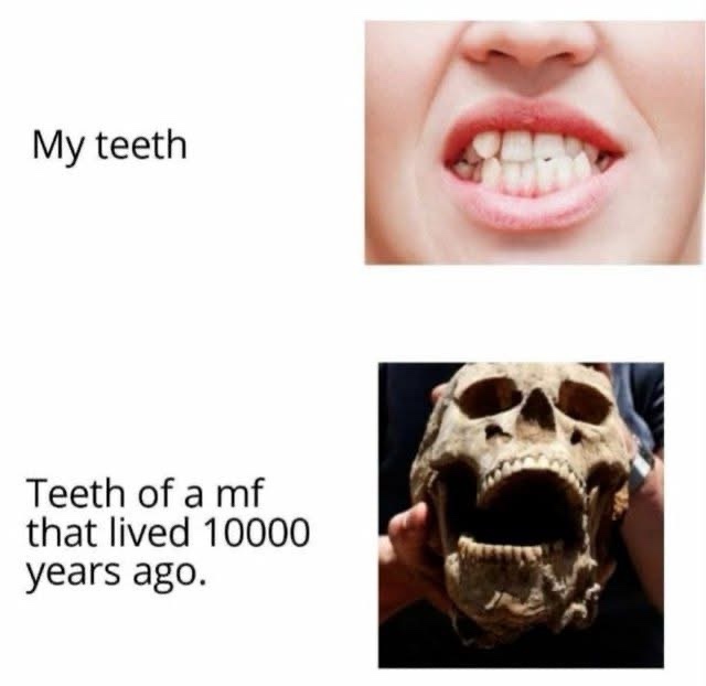 20 Funny Memes That Just… Happened 12 my tteth
