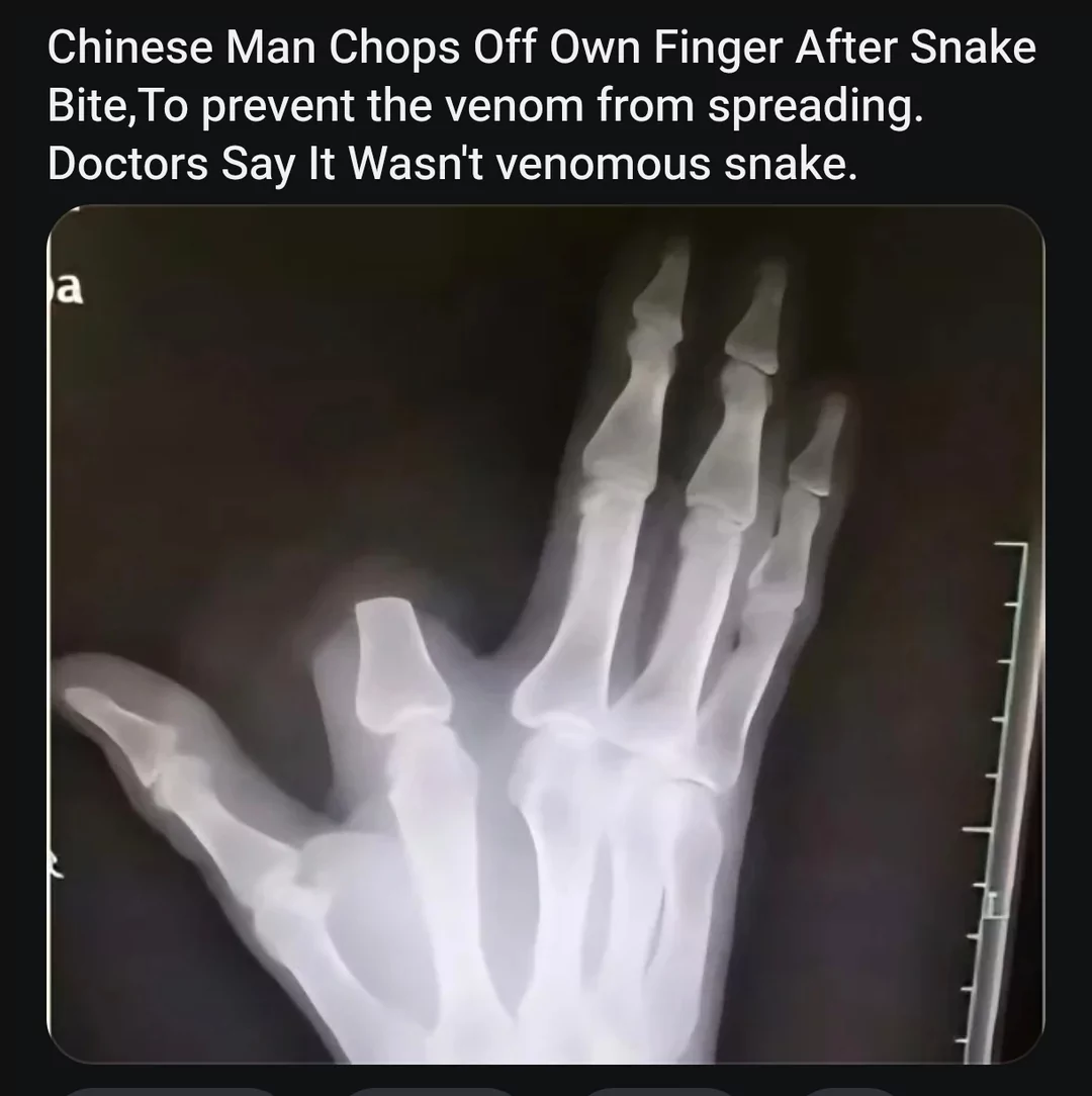 30 Snake Memes That Will Make You Sssmile on World Snake Day! 28 Chops off own finger