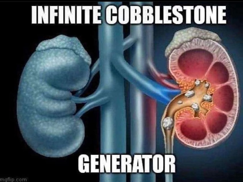 Infinite cobblestone