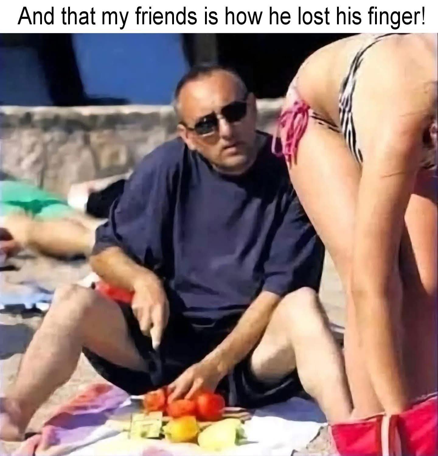 Friend lost his finger