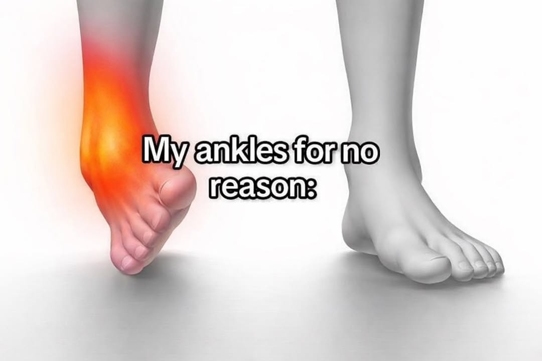 Ankles for no reason