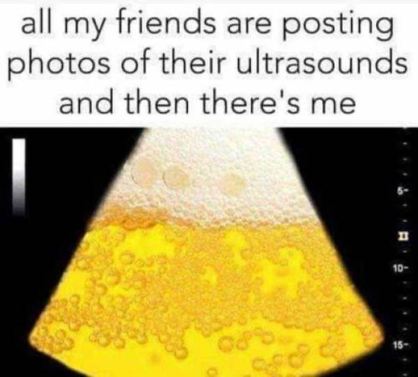 20 Memes That Feel Like They Were Made After Watching You All Day 13 Photos of ultrasound