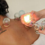 Profile picture of Cupping NYC